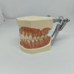 Studiemodel med Aftagelige Tnder 